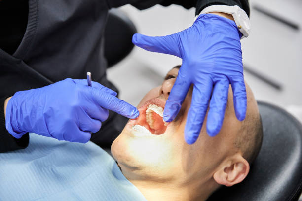 Best Dentist for Tooth Abscess  in Gettysburg, SD