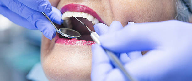 Dentist for Dental Trauma in SD